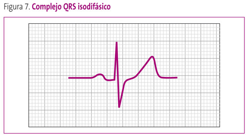 Figura 7. Complejo QRS isodifásico