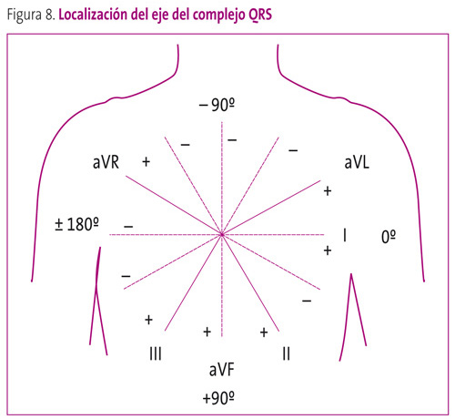 Figura 8. Localización del eje del complejo QRS